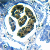 Anti-CD70 Antibody
