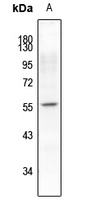 Synaptotagmin (Phospho-S309/306) Antibody