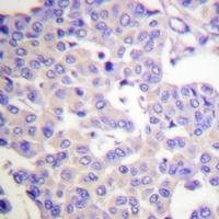 Synaptotagmin (Phospho-S309/306) Antibody
