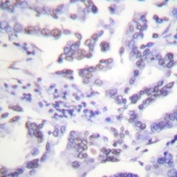 Anti-ABL1/2 (Phospho-Y393/439) Antibody