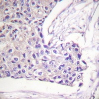 Anti-FOXO1/3/4 (Phospho-T24/32) Antibody