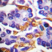 c-RAF (Phospho-Y341) Antibody