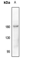CD115 (Phospho-Y723) Antibody