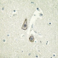 CD115 (Phospho-Y723) Antibody