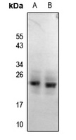 RGS1/8/16 (Phospho-Y187/159/168) Antibody