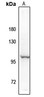 NF-kappaB p100 (Phospho-S869) Antibody