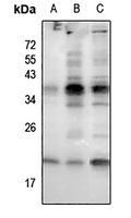 RAC1/2/3 (Phospho-S71) Antibody