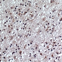 GLUR1 (pS863) antibody