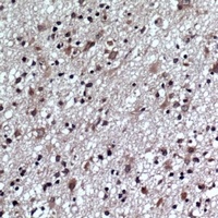 Anti-GLUR1 (Phospho-S863) Antibody