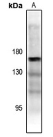 ASK1 (Phospho-T838) Antibody