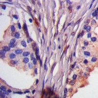ASK1 (Phospho-T838) Antibody