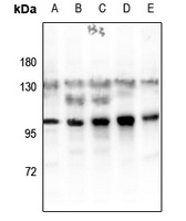 Glucocorticoid Receptor (Phospho-S203) Antibody