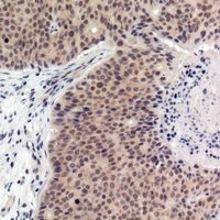 p53 (Phospho-T387) Antibody