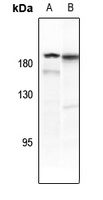 PDGFR beta (Phospho-Y771) Antibody