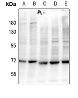 BLNK (Phospho-Y84) Antibody