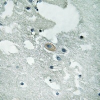BLNK (Phospho-Y84) Antibody