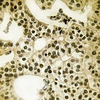 Anti-PALF (Phospho-S116) Antibody