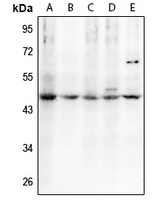 C/EBP alpha (Phospho-T230) Antibody