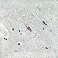 Anti-GAB2 (Phospho-Y643) Antibody