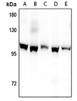 Kv2.1 (Phospho-S805) Antibody