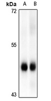 MK2 (Phospho-S272) Antibody