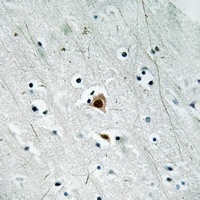 MK2 (Phospho-S272) Antibody