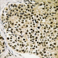 NFAT3 (Phospho-S168/S170) Antibody
