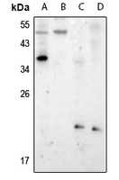 Presenilin 1 (Phospho-S357) Antibody
