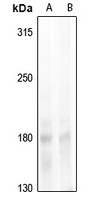 NCOA1 (Phospho-T1179) Antibody