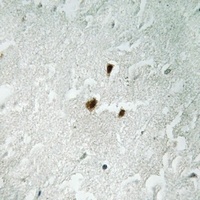 Anti-RRN3 (Phospho-S649) Antibody