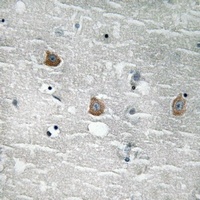 Anti-TOB (Phospho-S164) Antibody