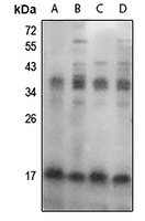 FHIT (Phospho-Y114) Antibody