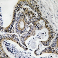 Anti-FHIT (Phospho-Y114) Antibody