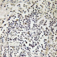 Lamin A/C (Phospho-S22) Antibody