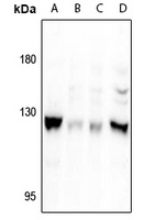 Focal Adhesion Kinase (Phospho-S722) Antibody