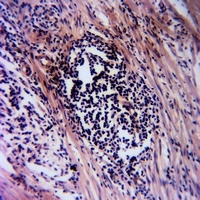 Anti-FGFR4 (Phospho-Y642) Antibody
