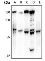 VAV1 Rabbit Polyclonal Antibody