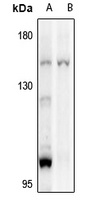 PLC gamma 2 Antibody