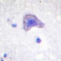 PLC gamma 2 Antibody