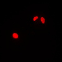 Anti-TRAP220 Antibody