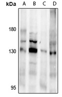 NMDAR1 Antibody