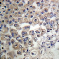 PLC beta 3 antibody