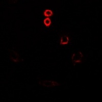 Anti-PLC beta 3 Antibody