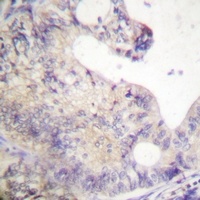 Anti-PFKFB2 Antibody