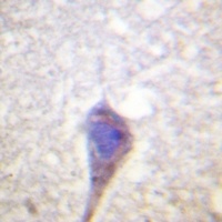 Anti-BCR Antibody