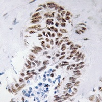 DAP Kinase 3 antibody