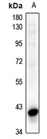 CD95 Antibody