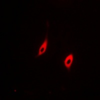CD95 Antibody