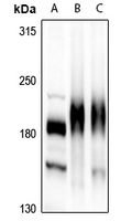 HER3 Rabbit Polyclonal Antibody
