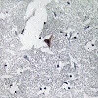 HER3 Rabbit Polyclonal Antibody